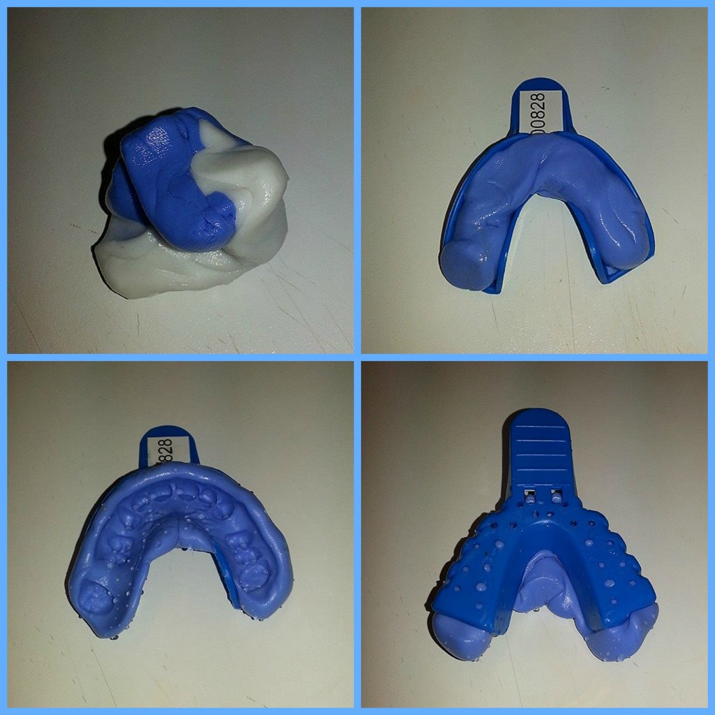 PicMonkey Collage teeth